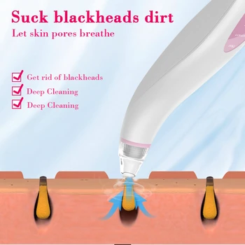 Sejas Blackhead Noņemšanas Instruments, Elektriskie Poru Cleaner Black Dot Pinnes Vakuuma Uzsūkšanas Sejas Tīrīšana Skaistumkopšanas Ādas Kopšanas Līdzeklis